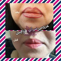 آرایشگاه زنانه موچین